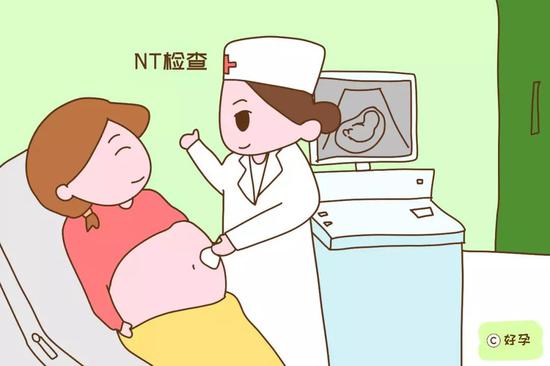 NT检查，这个数据值比较高