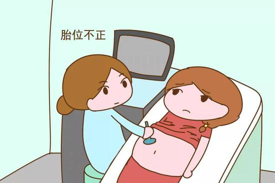 胎位不正